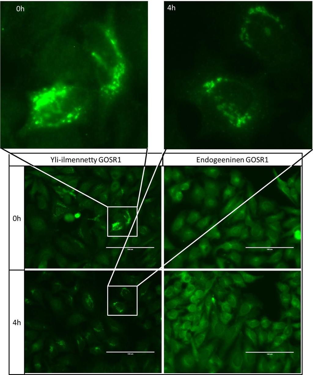 Kuva 4-5: HeLa-solut transfektoitiin GOSR1:llä, fiksoitiin metanolilla ja immunofluoresenssileimattiin anti-gosr1:lla.. Sekundäärivasta-aineessa on Alexa Fluor 488 - leima.