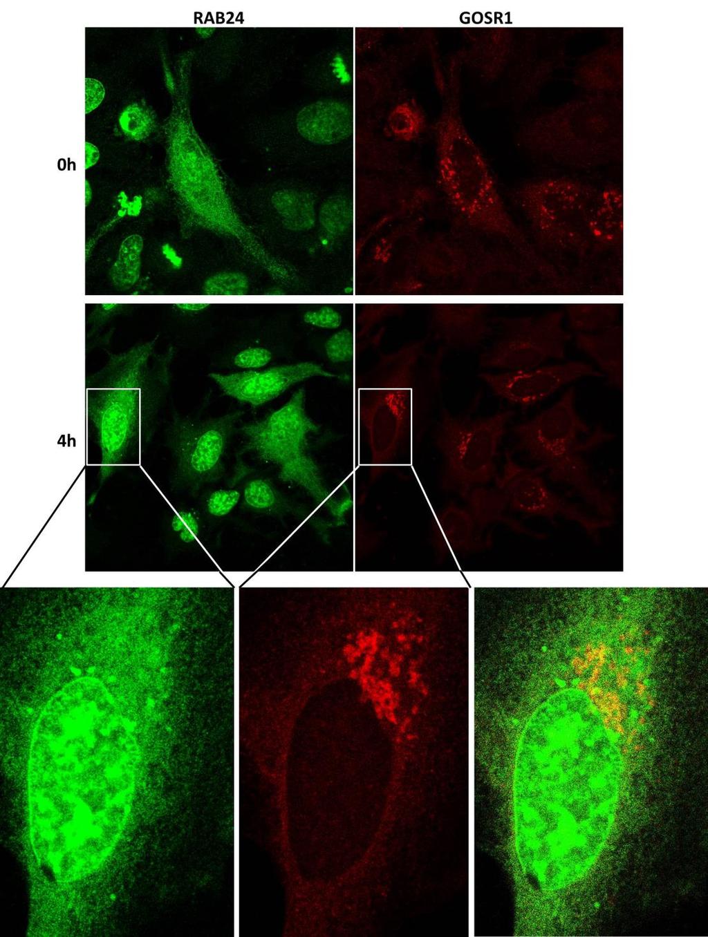 Kuva 4-6: mycrab24:ää stabiilisti yli-ilmentävät HeLa-solut transfektoitiin GOSR1:llä, fiksoitiin ja immunofluoresenssileimattiin RAB24:n ja GOSR1:n vasta-aineilla.