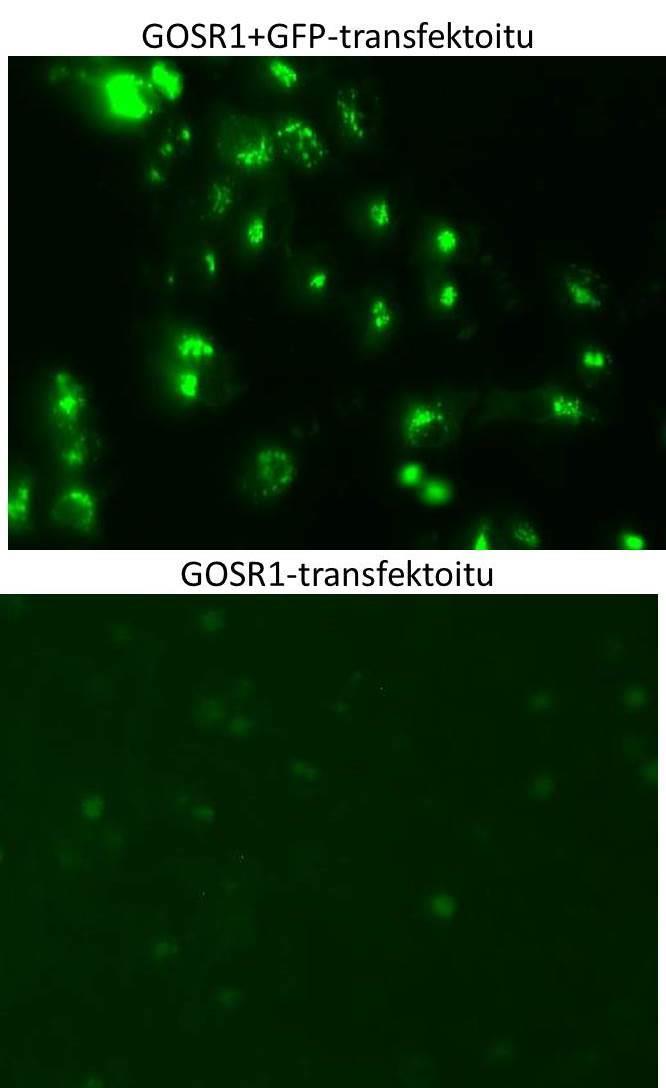 Kuva 4-8: HeLa solut transfektoitiin GFP-leimalla varustetulla GOSR1:llä ja kontrollina pelkällä GOSR1:llä. Soluja ei näännytetty.