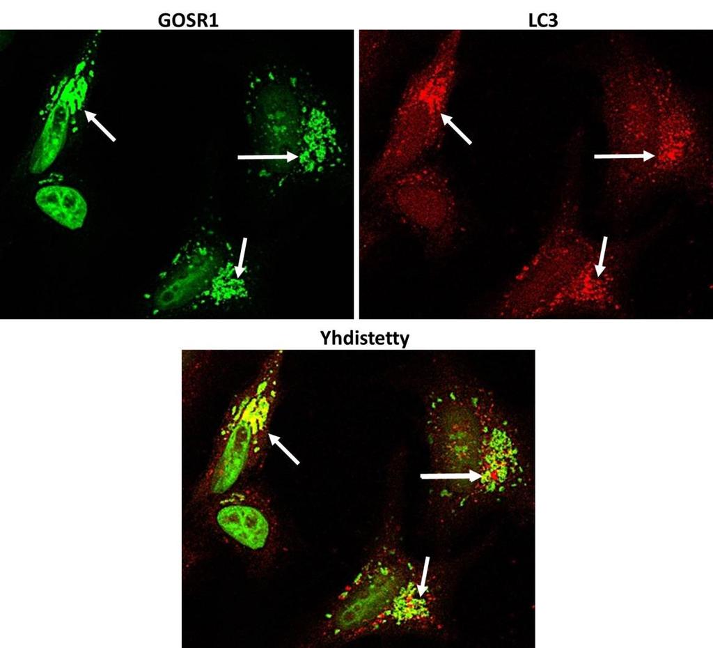 Kuva 4-9: HeLa-solut transfektoitiin fuusioplasmidilla GOSR1+GFP, fiksoitiin ja immunofluoresenssileimattiin LC3 vasta-aineella.