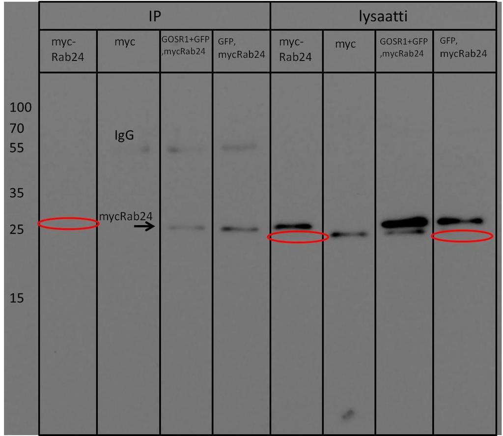 ilmentävistä HeLa-soluista, joista yhdet oli transfektoitu GOSR1-GFP:llä, yhdet pegfp:llä ja yhdet olivat transfektoimattomat.