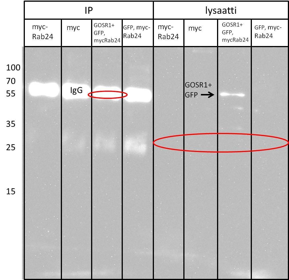 GOSR1-blotista (Kuva 4-15) puuttui odotusten vastaisesti endogeenistä GOSR1:ä vastaava juova (28 kda) kaikista lysaattisupernatanteista.
