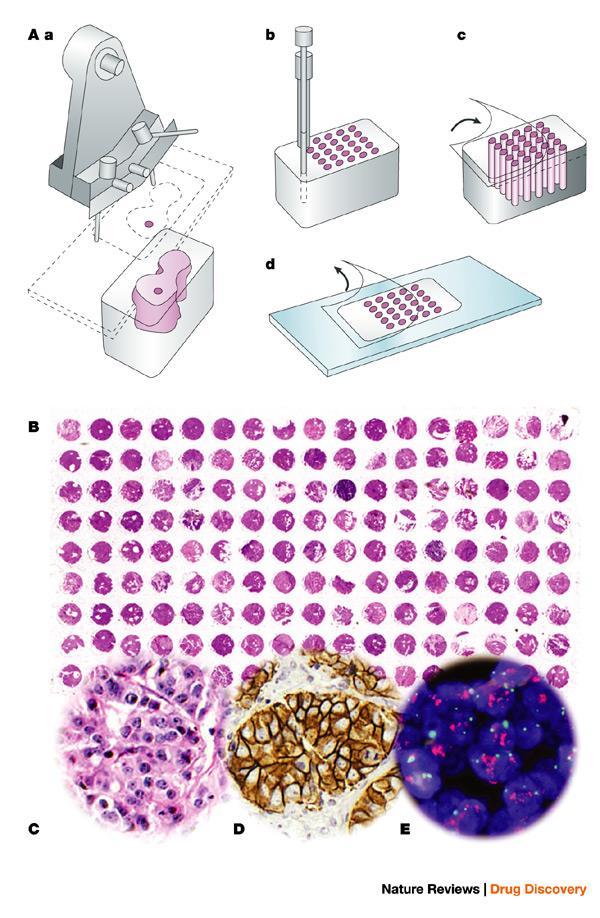 Tissue microarray biopankkipalveluna 2017 - SA-Firi-rahoitusta TMAmonikudosblokkilaitteistoon Oulu, Kuopio (laitteet hankittu) Haasteena edelleen esim kuvien pitkäaikaissäilytys ja jakaminen