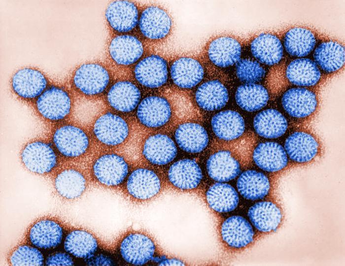 10 Rotaviruksen diagnosointiin on erilaisia vaihtoehtoja. Yleisesti on käytössä jo aiemmin mainittu immunokromatografinen menetelmä (EIA), joka soveltuu hyvin pikadiagnostiikkaan.