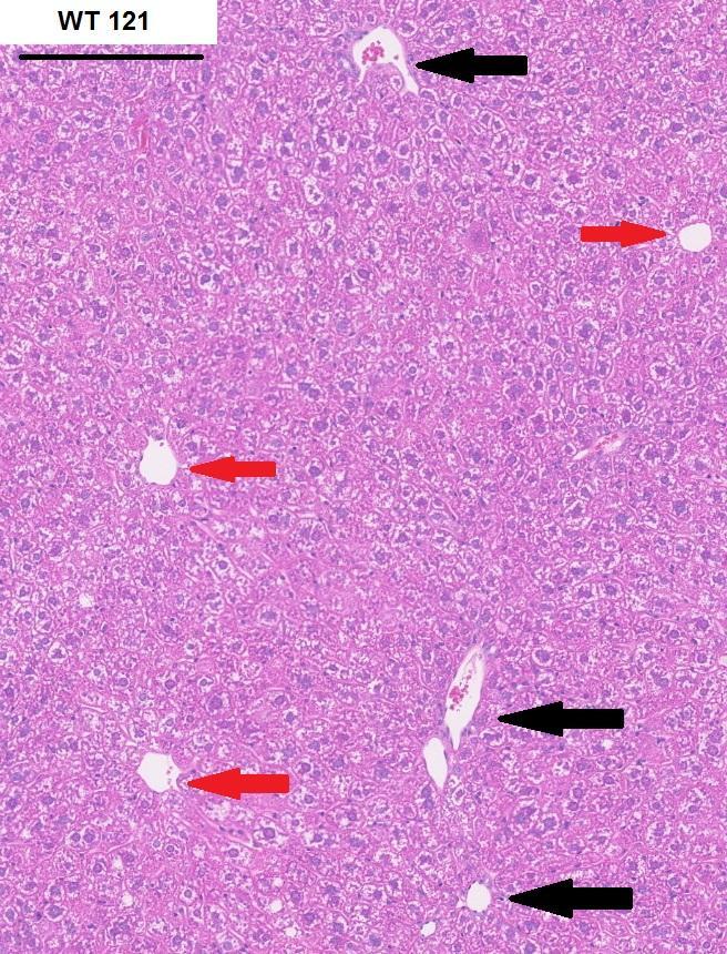 27 nuolet osoittavat. Maksan histologista rakennetta oli vaikea erottaa runsaan rasvan joukosta. Kuva 6. Villityypin uros (WT 121) vasemmalla ja HSD17β13-poistogeeninen uros (HOZ 34) oikealla.