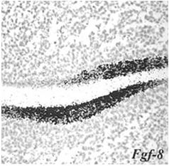 leukaluu Gene Expression in Tooth - a graphical data-base