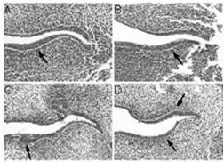 transcription factor p63 Hampaiden ja