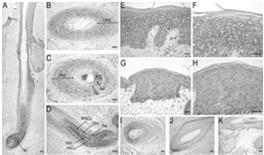 Nectin-1 deficient mice exhibit reduction of desmosomal junctions and have mild enamel defects