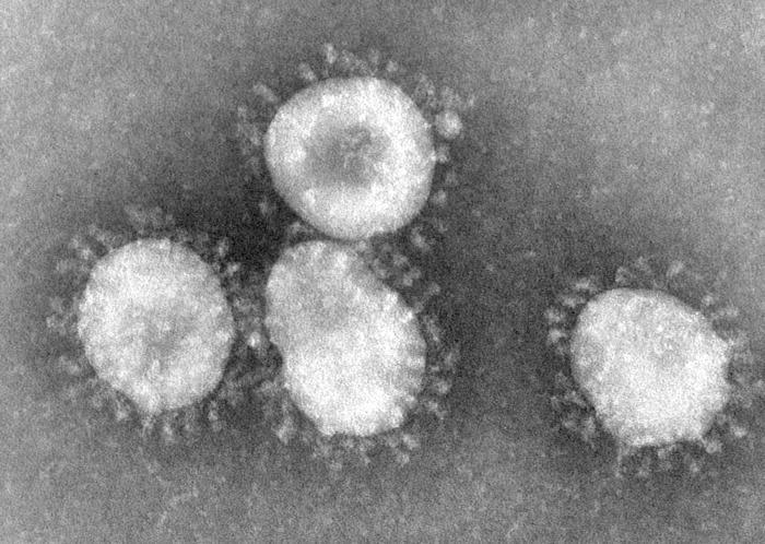 pitkulainen TMV Replikaatio: genomin monistus Transkriptio: lähetti-rna:n
