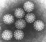 triangles; Geodesic Dome Parvovirus, T=1 Adenovirus, T=25 Rotavirus, T=13 VIRUSTEN