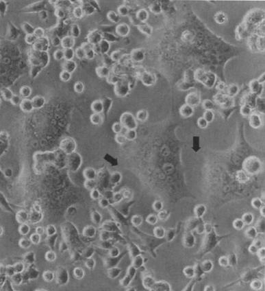diagnostiikka ja antiviraalisen hoidon seuranta > genotyyppaus > molekulaari-epidemiologiset ja evoluutiotutkimukset Antiviraalisia aineita (lääkkeitä) käytetään hoidossa.