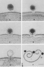 sytoplasmaan b) Virusvaipan ja solukalvon yhteensulaminen c) Virus kulkeutuu soluun