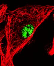 VIRUKSEN KULKEUTUMINEN SOLUSSA Vaipaton DNA-virus (CPV) kulkeutuu solurakkuloiden avulla tumaan: Cytoplasm Viruses Clathrin- Coated vesicles Early endosome Carrier vesicle Late endosome Lysosome