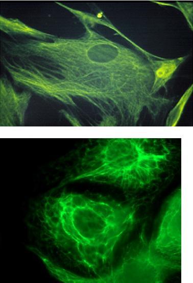 Välikokoiset säikeet eri kudoksissa Mesenkymaaliset solut vimentiini Epiteelisolut sytokeratiinit