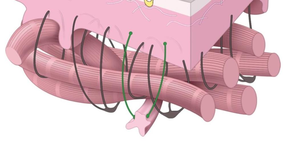 VII) Tarttumispiste on löyhempi liitos Lamina basalis Lamina reticularis Levyproteinit Tyvikalvo