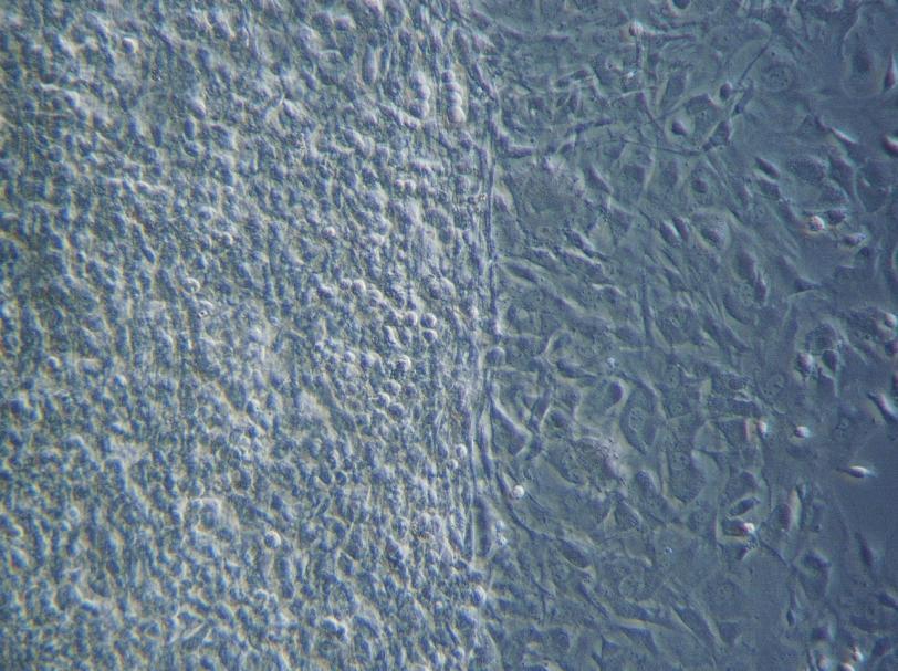 32 Kuvassa 11 on 1. kasvatuksen T- solujen luunodulimuodostumaa päivänä 24 (valkoinen nuoli).