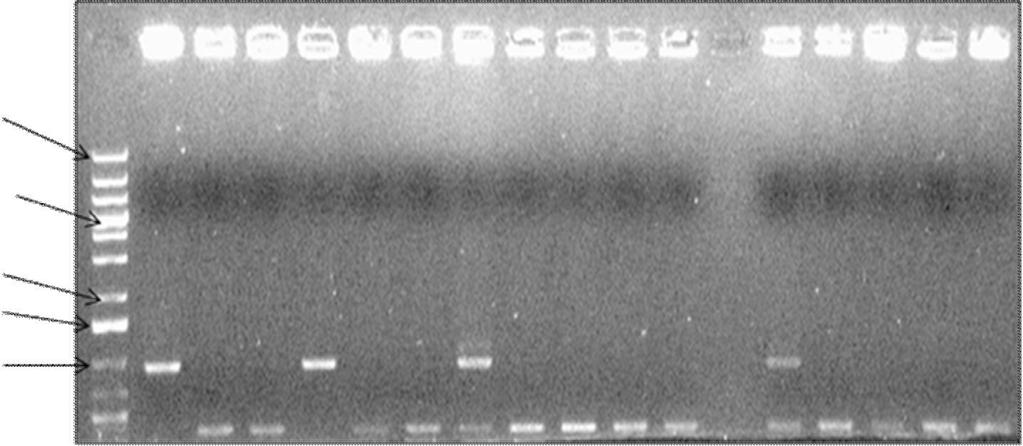 Kaivossa 1 on GenRuler 1 kb DNA-ladder, kaivoissa 2-8 sekä 10-17 hiivapesäkkeet ja kaivossa 18 negatiivinen kontrolli. Kuvassa 8 on vain neljä pesäkettä, jotka sisältävät insertin.