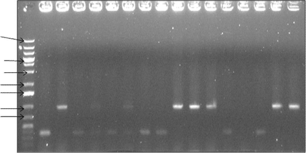 Kaivossa 1 on GenRuler 1 kb DNA-ladder, kaivoissa 2-16 hiivapesäkkeet ja kaivossa 17 negatiivinen kontrolli. Kuvassa 10 on vain kuusi pesäkettä, jotka sisältävät insertin.
