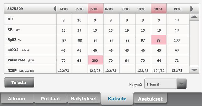 Huomautus Tällä välilehdellä fysiologisen hälytyksen laukaisseet mittaukset näkyvät korostettuina. 2. Muokkaa trendiaikavälilä valitsemalla Näkymä-luetteloruutu.