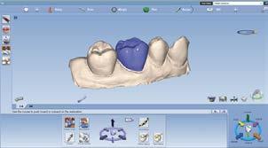 for Dental labs