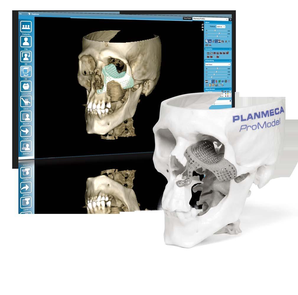 CAD/CAM solutions Patient-specific