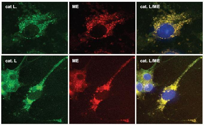 Proteolyyttiset entsyymit