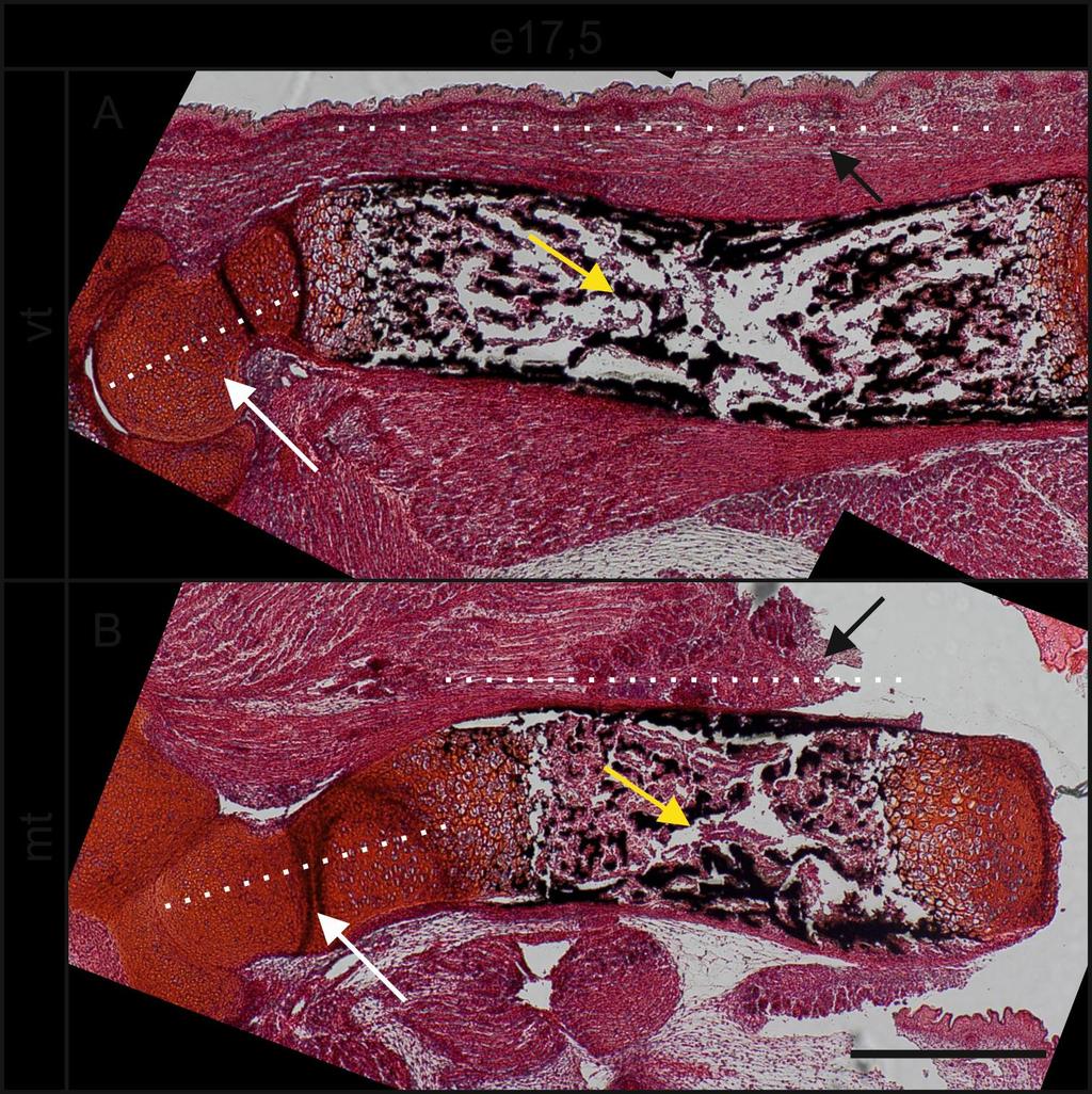 13 Kuva 2: e17,5-ikäisten olkaluiden von Kossa / Safranin O -värjäys, mittapalkki 500 µm.