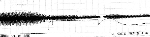 Käyttöönotossa mitattujen pääkoneen staattorivirran ja herätinkoneen magnetointivirran käyrämuodot ovat kuvassa 1.13. Kuva 1.13. Mittausdataa hiomakonemoottorin käyttöönotosta.