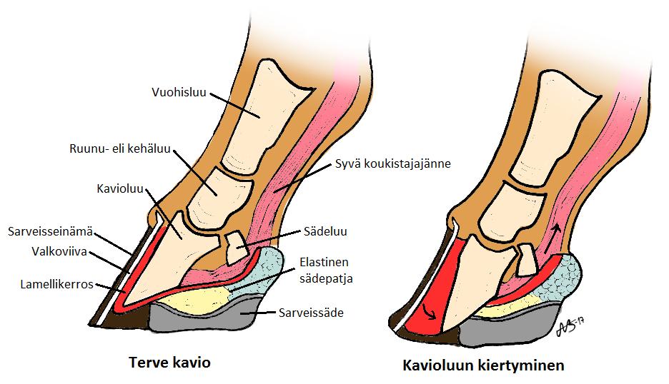 KUVIO 3. Kavion rakenne ja muutokset kavioluun kiertymässä (Kuva: Alisa Bragge) Kaviokuumeella on useita eri syntymekanismeja ja muotoja. Yleisin on hormoniperäinen eli endokrinopatinen kaviokuume.