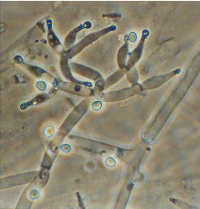 Keissi 3: Sienen (homeen) tuottama jonikanavia muodostava peptidi.