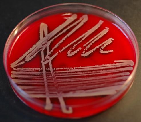 MRSA MRSA = Metisilliiniresistentti Staphylococcus aureus Resistentti lähes kaikille beetalaktaameille meca /mecc -geeni bakteerin kromosomissa