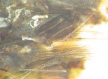 Tämän jälkeen petrimaljoissa olevat kasvijäänteet määritettiin ja laskettiin yksi kerrallaan mikroskoopin alla sekä valokuvattiin ja lopulta säilöttiin lasiputkissa alkoholi-glyseroliseoksessa.