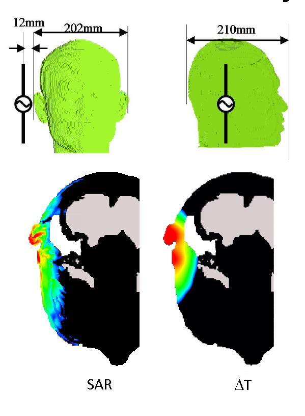 Lämmönvirtaus tasoittaa lämmönnousua Kuumat SAR pisteet syöttävät lämpöenergiaa kehoon. 6 GHz SAR lasketaan 10 gramman kudosmassan keskiarvona.