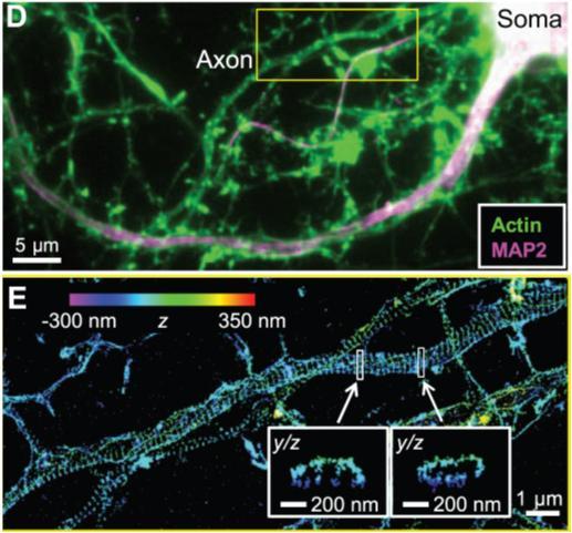 Superresolution fluorescence microscopy Aktiinin säännöllinen järjestyminen hermosäikeessä (STORM) Xu et al.