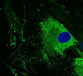 Procollagen I Hsp47 Colocalization channel