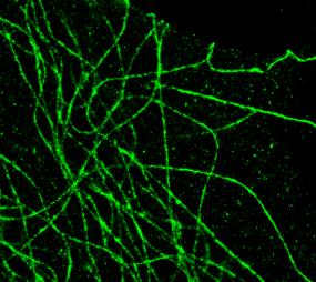 , Nature Methods 2012;9:755-763) Superresoluutio mikroskopia Valomikroskoopin resoluutio voi parhaimmillaan olla vain noin puolet käytetyn valon aallonpituudesta, näkyvän valon alueella siis noin 200