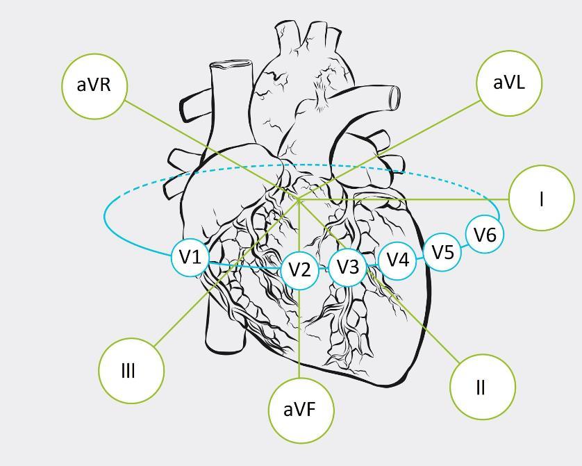 14 3.1.1 Kytkennät Yleisimmin käytetty EKG-rekisteröinti on niin sanottu 12-kytkentäinen, jossa iholle kiinnitetään kymmenen elektrodia. Jokainen elektrodi tarkkailee sydäntä eri suunnasta.