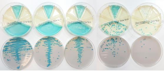 34 Kuvio 17. Laimennossarja Enterococcus faecalis -kannasta molemmilla maljoilla.