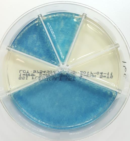 kasvaa siinä vihreänä tai harmaana (Kuvio 18). Kuvio 18. Enterococcus faecium molemmilla maljoilla.