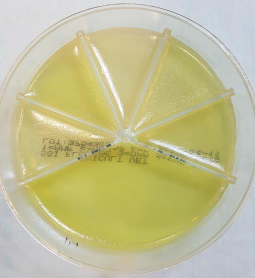 35 Kuvio 19. Pseudomonas aeruginosa molemmilla maljoilla.