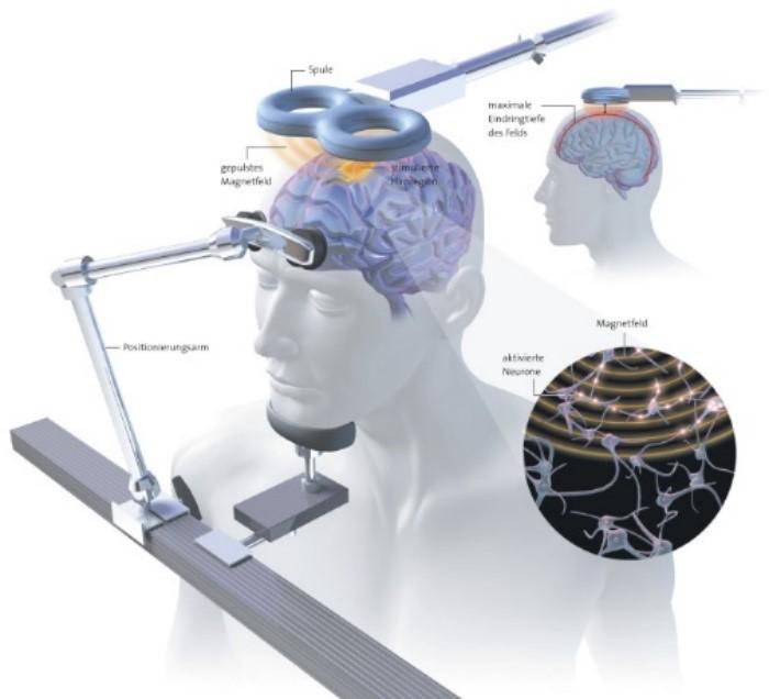 Aivojen magneettistimulaatio perustuu siihen, että muuttuva magneettikenttä aiheuttaa sähkövirran johteeseen (Geddes 1991).