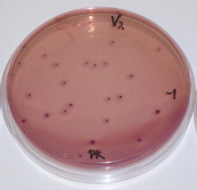 23 KUVA 2. Enterobakteereja VRBG-agarmaljalla. 5.2 Kasvatusalustat ja reagenssit Laboratoriotyöskentelyssä on tärkeää, että käytössä olevat elatusaineet toimivat asianmukaisella tavalla.