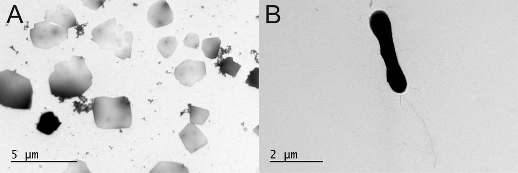 4.1.2. Adsorption tutkiminen elektronimikroskopialla Tässä työssä yhtenä tavoitteena oli HVTV-1-viruksen adsorptiokohdan selvittäminen.