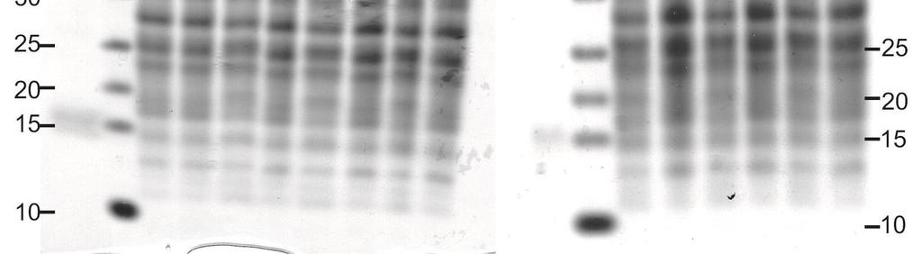 TCA-saostetuista supernatanteista ajetuissa 14 % trisiini-sds-page -geeleissä (kuva 12) infektoidussa kasvatuksessa proteiineja nähdään geelissä vasta lyysauksen jälkeen otetuissa näytteissä.