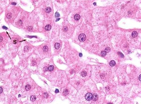 Luku 1 TUMA JA SOLUSYKLI Viereinen kuva on otettu maksakudoksesta tehdystä histologisesta valmisteesta.