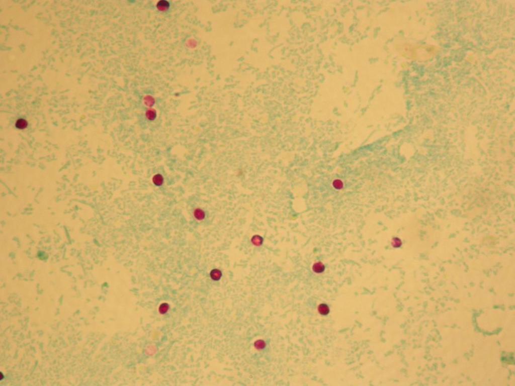 Kuva 3. Ziehl-Neelsen menetelmällä värjättyjä Cryptosporidium-ookystia. Ookystat näkyvät punaisina, pyöreinä kappaleina vihertävää taustaa vasten. Valomikroskooppi, 400x suurennos.