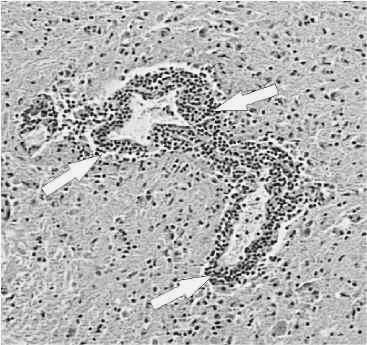serologia (IgM, IgG +avid) Rabies Tauti kuvattu 2000 v sitten; Rokote1885 /Pasteur Itää useimmiten 20-60 vrk (ad