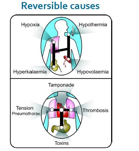 Perioperatiivisen