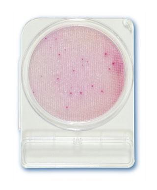 KUVA 8. Enterobakteeripesäkkeitä Compact Dry ETB -kuivamaljalla (Compact Dry ETB -kuivamalja 2012) 3.