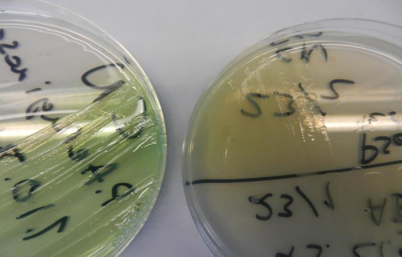 25 14.2 CN-agar CN-agaria käytetään Pseudomonas aeruginosa -bakteerin vesimikrobiologisissa määrityksissä (Kuva 5).